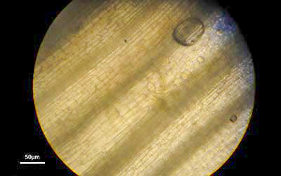 pythium blight