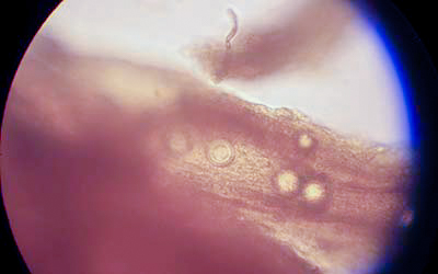 pythium root rot