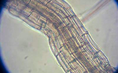 pythium root rot